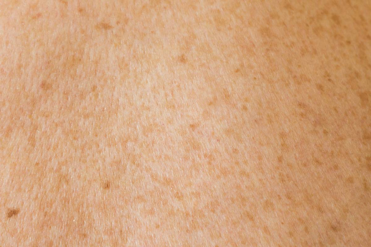 Close-up of dog skin before and after using medicated dog shampoo for skin allergies showing healed lesions and regrown fur